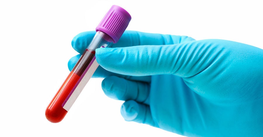 dwi blood draw